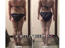 エステティックサロン サクラ(SAKURA)