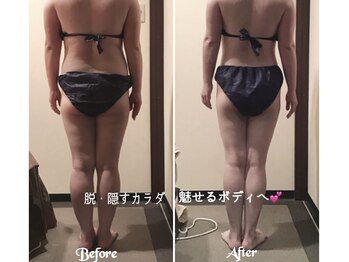 エステティックサロン サクラ(SAKURA)