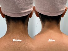 クイーン 渋谷店(QUEEN)/オフショル着るなら