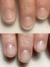 スマイルニコ(smile nico)/