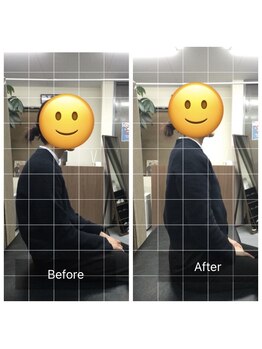 ナオル整体 センター南院(NAORU整体)/猫背姿勢のBefore After