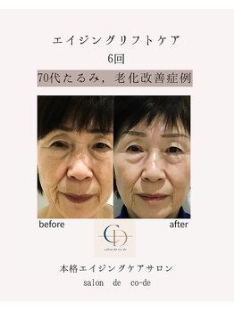 サロンドコーデ(salon de co-de)/エイジングリフトケア