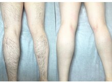 エヴァワックス 大阪 南堀江店(Eva Wax)/脱毛/ブラジリアンワックス