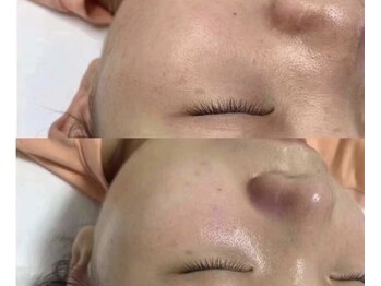 花梨(カリン)/保湿、リンパのデトックス