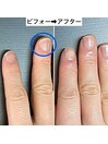 自爪の変化は自分で気付きにくい