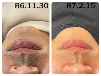 フィズ 五日市彩が丘店(FIS)/☆before/after☆都度払い