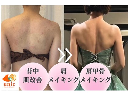 ユニック(unic)の写真