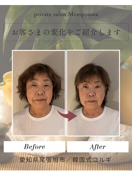 ムンプソナ(Mempesona)/ビフォーアフター♪