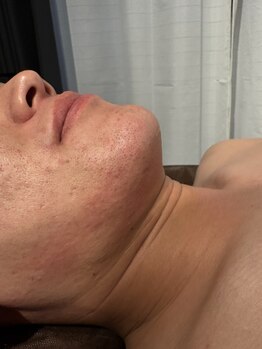 ネフェル(Nefer)の写真/【プライベートサロン◆】エリアでは数少ないメンズ脱毛に対応！男性のお客様が多数ご来店◎