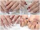 リノネイル(Rino-nail)の写真