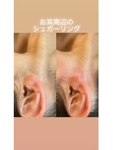 ララルアナ(Lara luana)/スッキリ！うなじ美人