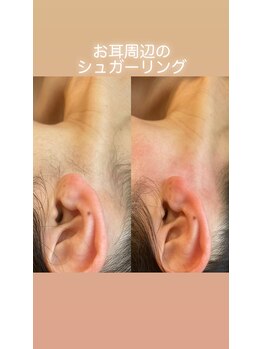 ララルアナ(Lara luana)/スッキリ!うなじ美人