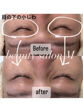 エム(M)/シワケアにはこれが最強！！