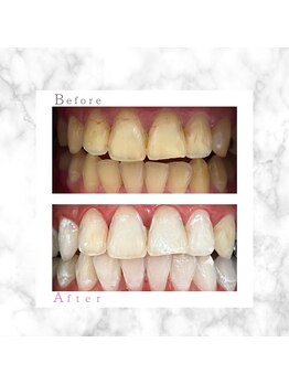 ホワイト 上乃木南店(WHITE)/ビフォーアフター