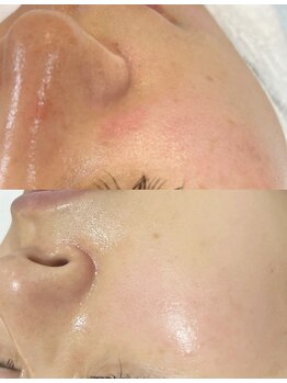 ユミサロン(U Mi Salon)/乾燥知らずの、なめらかな素肌へ