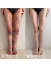 シンシアリー 広瀬通店(Sincerely)/before→after【脚】