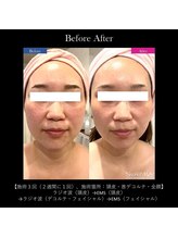 フルオール(FRUOR)/巡り&エイジングケアで肌質改善