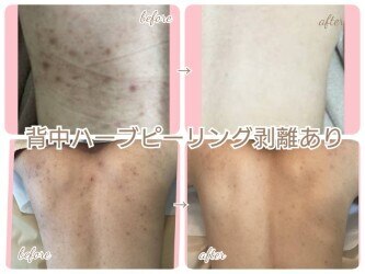 キッカ 梅田天六(Kikka)｜ホットペッパービューティー