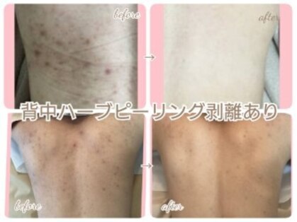 キッカ 梅田天六(Kikka)の写真