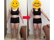 美容整体院元 光の森店/J・M様のビフォーアフター