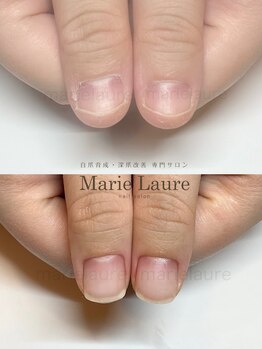 マリーロール 梅田店(Marie Laure)/深爪改善/自爪育成/ネイルケア
