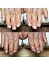 リリ(lili)/ネイルスキンケア1回目