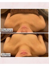 ビジョイ(Bejoy)/バストコース　BeforeAfter