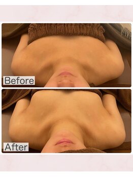 ビジョイ(Bejoy)/バストコース　BeforeAfter