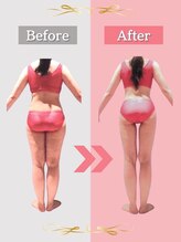 ピュアエステブリアント 銀座店 30代 痩身結果