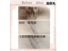 ミヤビ(MIYABI)の雰囲気(脱毛することで清潔感UP!モチベーションも上がります!)