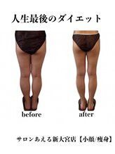 サロンあえる 新大宮店/体も心も軽やかに日々を楽しんで