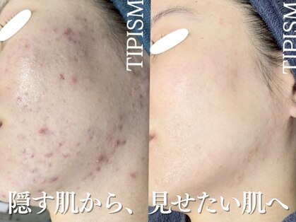 エル(Elle)の写真