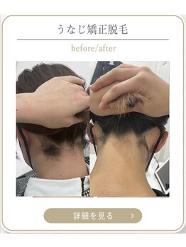 ミース 上野店/結婚式前のうなじケア