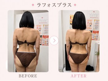 パールプラス 大田原店(Pearl plus)/肩こり/腰痛/姿勢/巻肩改善