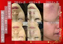 シェリー トウキョウ 西葛西店(Cherie Tokyo)