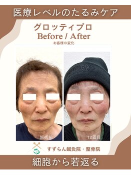すずらん鍼灸院 整骨院の写真/整骨院で叶える、上向きフェイスライン。プロの技術でたるみ改善。国家資格者在籍★キッズスペース有★