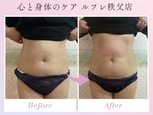 ルフレの雰囲気（大人気★最新脂肪冷却★脂肪冷却4カップ同時にEMSも♪）