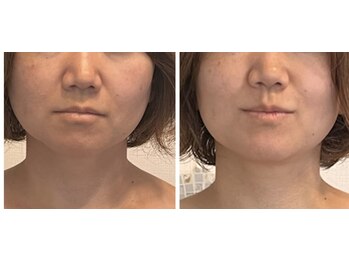 ダーナ(Danam)/マイナス5歳若見え！歪み改善も