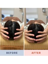 市川本八幡リーフ整骨院/ビフォーアフター/頭痛整体