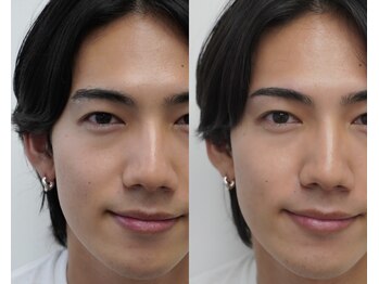 ハリウッドブロウリフト ワクシー 表参道店(HOLLYWOOD BROW LIFT WAXYYY.)/メンズ ハリウッドブロウリフト