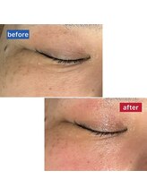 サロン ド メタセコイア(salon de Metasequoia)/フェイシャル