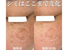 サロンドベルム(Salon de BELME)