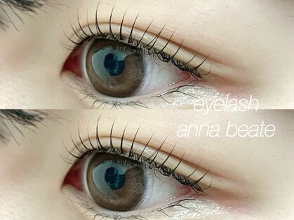 アンナボーテ(Anna beate)の写真