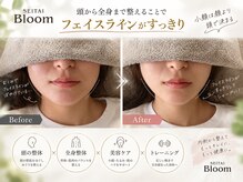 ブルーム(Bloom)の雰囲気（慢性の痛みや凝りだけでなく、小顔など美容にも特化してます）