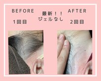 アリー(Aller)