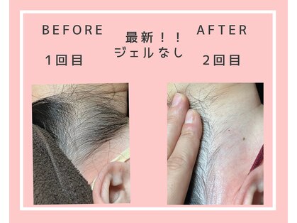アリー(Aller)の写真