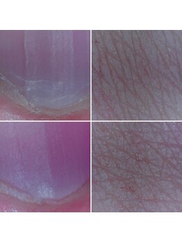 ココデネイル(cocode nail)/明日、結婚式の前撮りなんです!