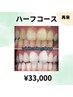 【効果しっかり実感したい方◎】美白セルフホワイトニング40分×5回 ¥33000