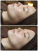 ウララ(ulala)/セラピール1回目