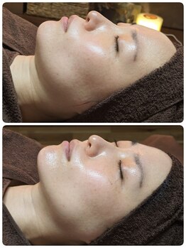 ウララ(ulala)/セラピール1回目